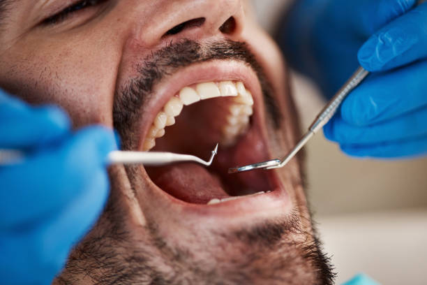 Best Emergency Dental Care for Trauma or Injury in Versailles, PA